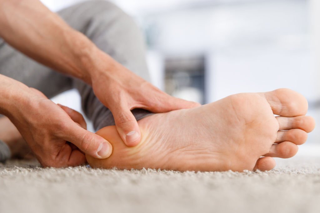 Read more about the article Plantar Fasciitis