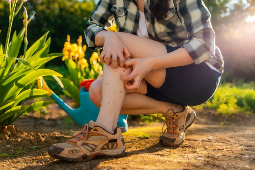 Read more about the article Tick-Bite Fever